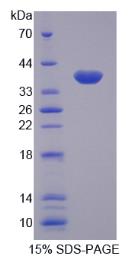 SDS-PAGE (TNFAIP3-566H).jpg